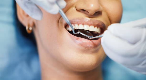 Best Knocked-Out Tooth (Avulsed Tooth) Treatment in St Bonifacius, MN